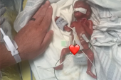 Kada se rodio, nije bio veći od očevog dlana i nije imao nikakve šanse da preživi: Rođen sa 283 grama,  danas ispisuje istoriju (FOTO)