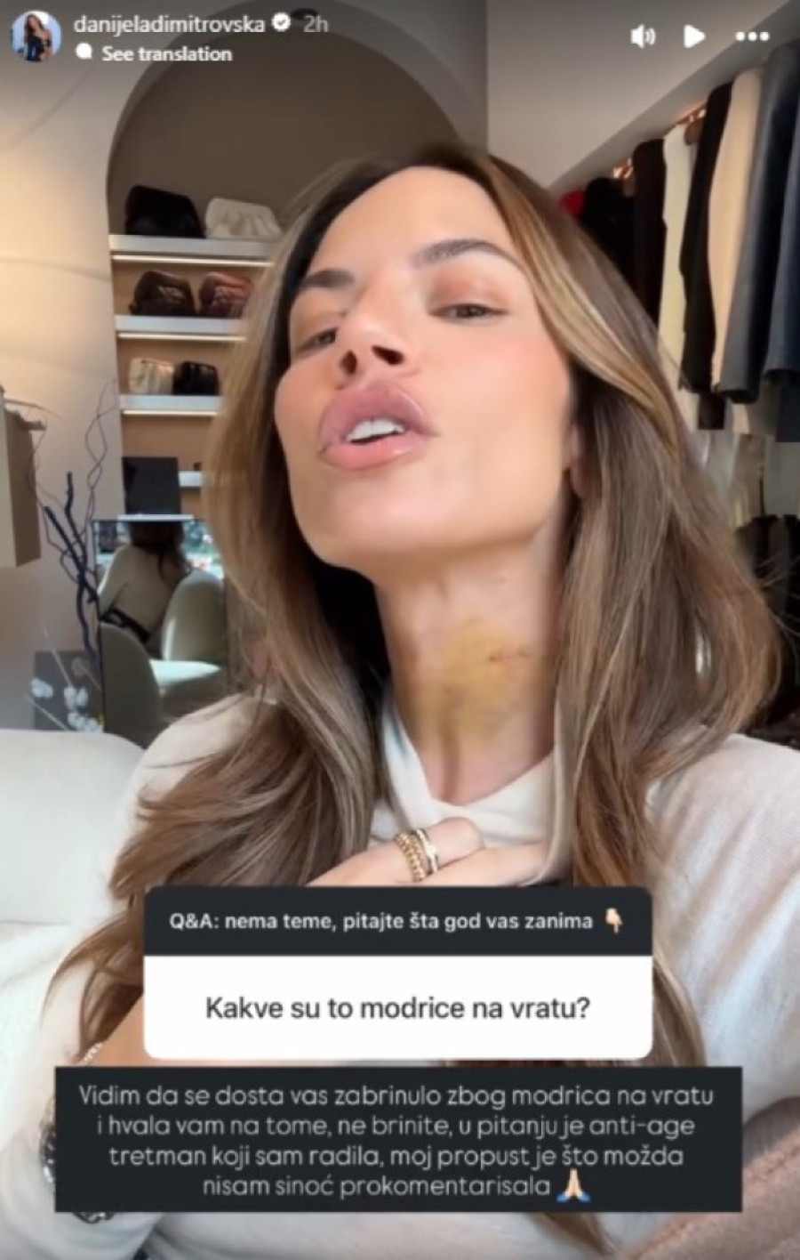 Zastrašujuće fotke: Danijela Dimitrovska u podlivima i modricama