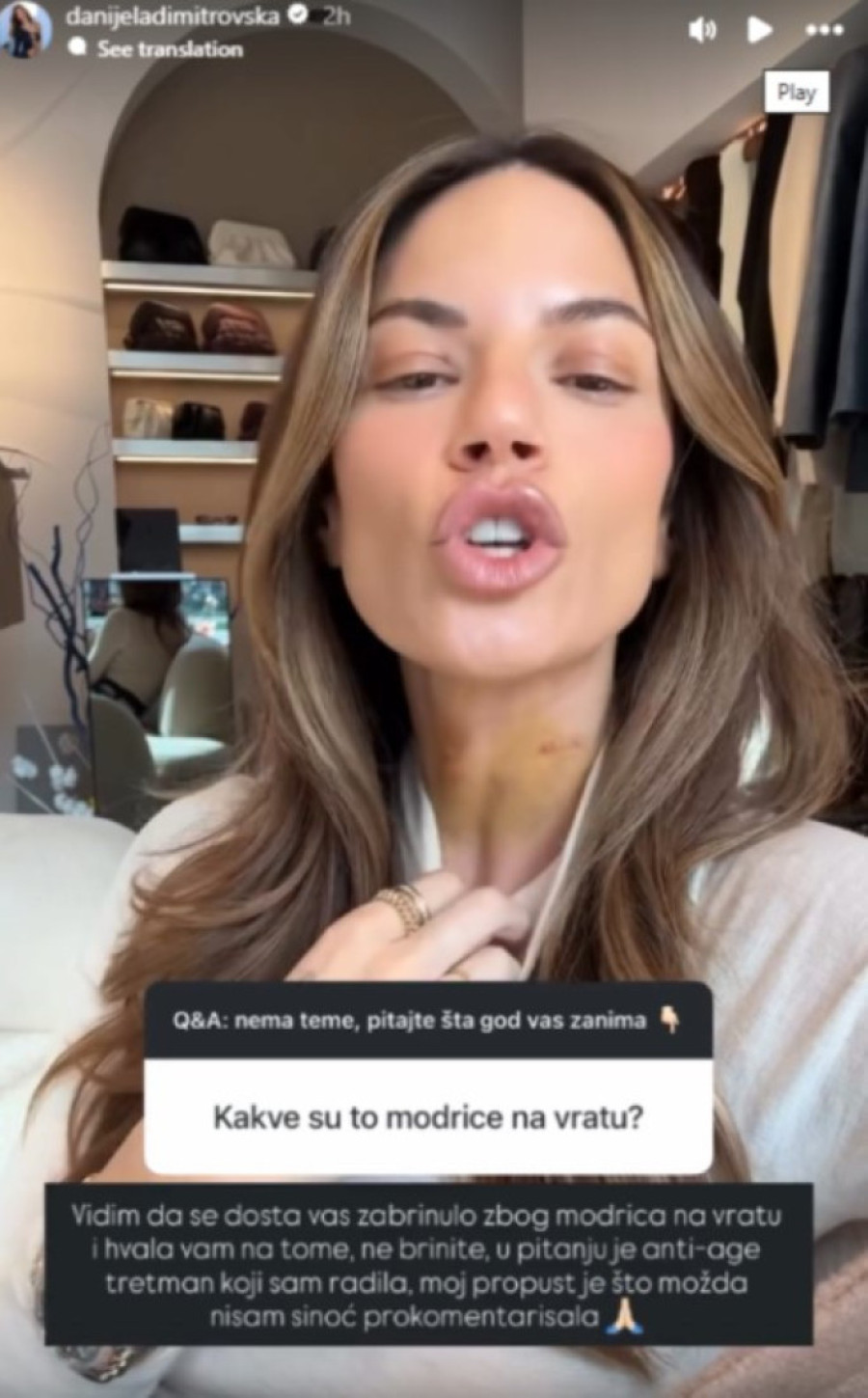 Zastrašujuće fotke: Danijela Dimitrovska u podlivima i modricama