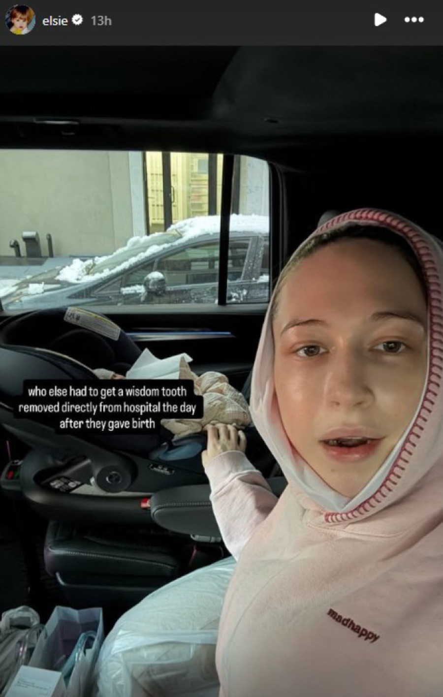 Odmah posle porođaja morala da povadi ove zube! Devojka Pita Dejvidsona pokazala kako sad izgleda (FOTO)