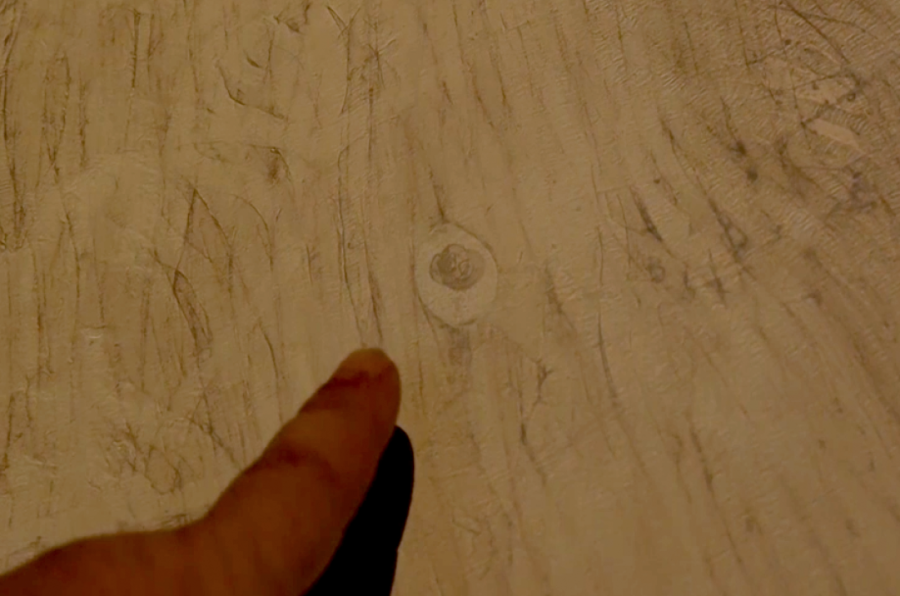 Novi detalji o širenju trihineloze u Pančevu: 17 ljudi jelo zaraženo meso, evo u kakvom su stanju!