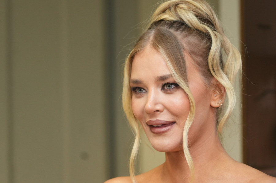 "Kao da su me pčele izujedale"  Estetka korekcija uništila Sofiju Milošević!