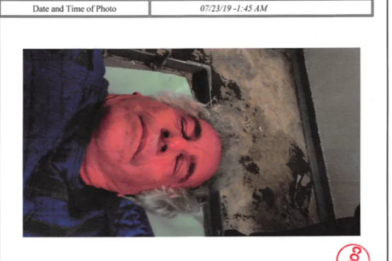 Digao ruku na sebe tri nedelje pre smrti: Ovako je Epstin izgledao posle neuspelog pokušaja samoubistva (FOTO)