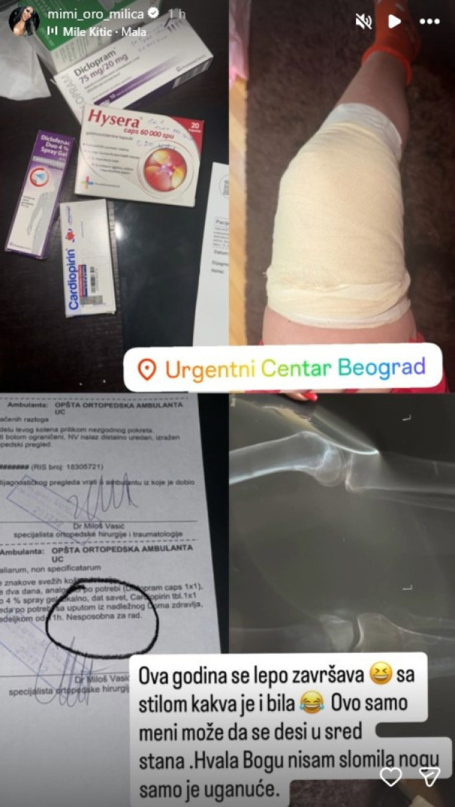 Starleta završila na ortopediji! Zadobila povredu usred stana: "Ova godina se lepo završava"