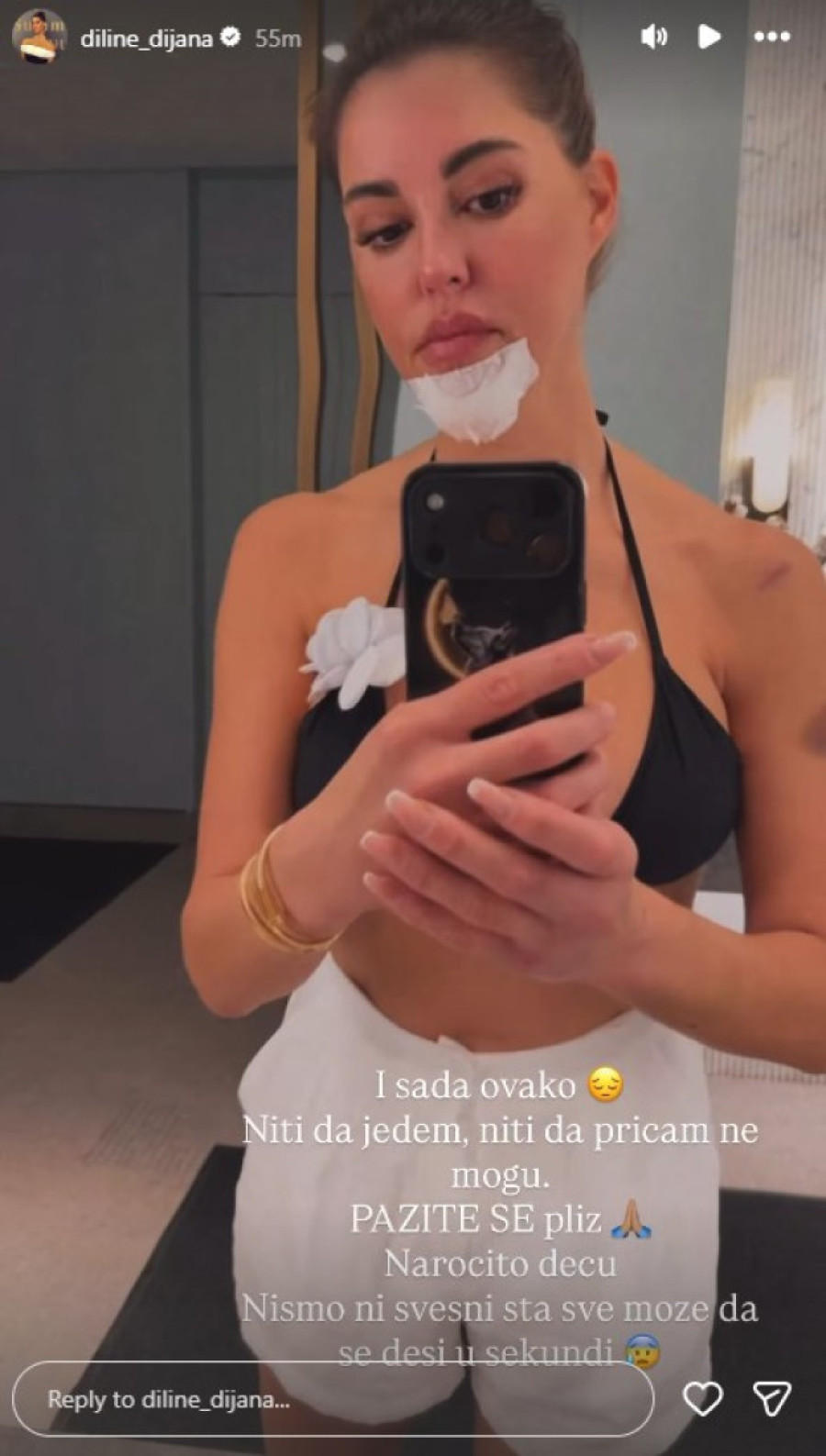 Dijana Dilajn posle operacije otečena: Intervencija je trajala tri i po sata (FOTO)