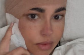 Dijana Dilajn posle operacije otečena: Intervencija je trajala tri i po sata (FOTO)