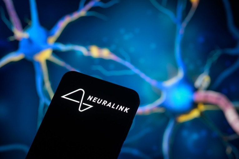 Prvi Britanac sa Maskovim Neuralink čipom opisuje čudesan osećaj kontrole paralizovane ruke