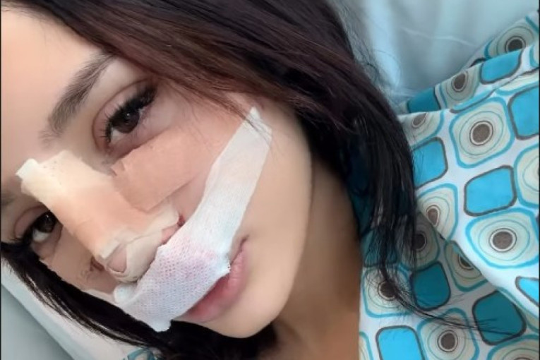 Nina Đogani operisala nos: Jezivi kadrovi posle intervencije! (FOTO)