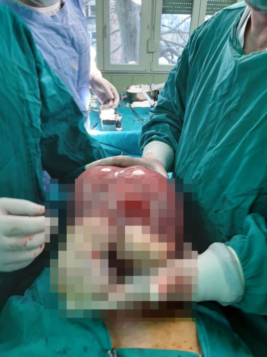 Srpski hirurg koji svakodnevno spasava živote: Priča o dr Vasku Tošiću (FOTO)