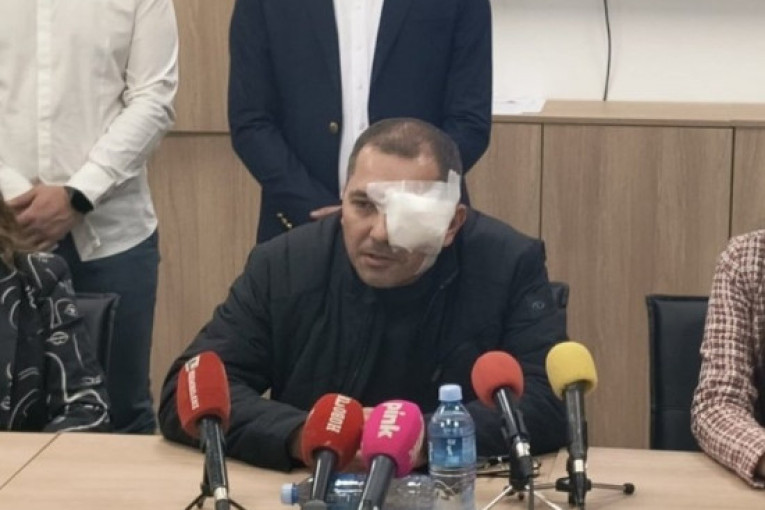 Munjevita akcija policije: Uhapšen napadač na aktivistu SNS-a