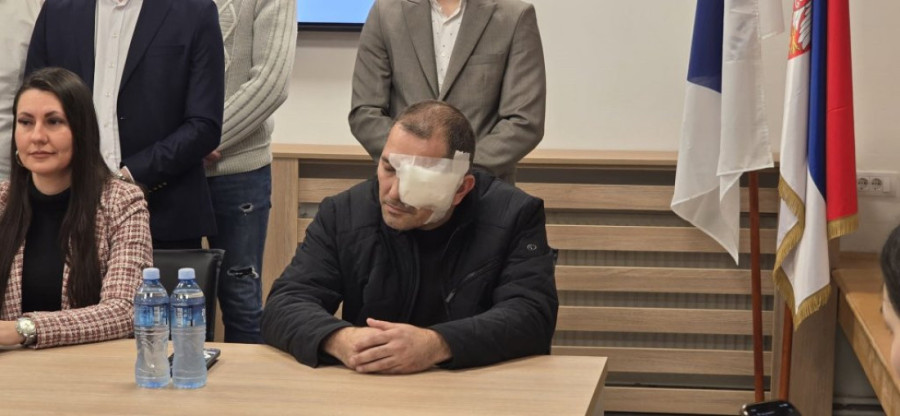 Munjevita akcija policije: Uhapšen napadač na aktivistu SNS-a