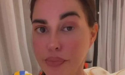 "Leva strana lica mi nema funkciju" Dijana Dilajn prolazi agoniju nakon nezgode u Dubaiju