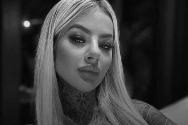 Preminula popularna influenserka (27): Pozlilo joj nakon plastične operacije!