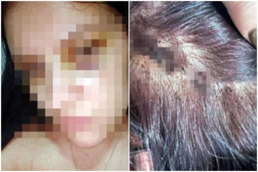 Otac sa KiM terao svoje troje maloletne dece na prosjačenje! Užas u Crnoj Gori