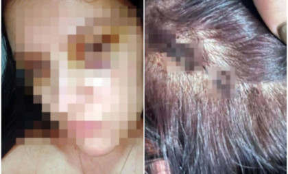 Osuđen siledžija iz Berana! Tukao Dejanu i dok je ležala bez svesti!