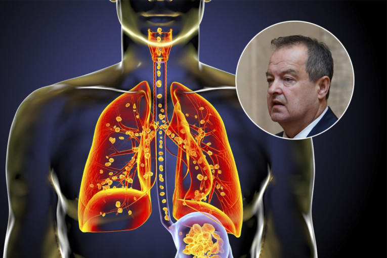 Plašimo se ambrozije, a ovo drveće nam sada zadaje muke sa alergijama: Jova tek dolazi, a evo koje je već u "žutoj zoni"