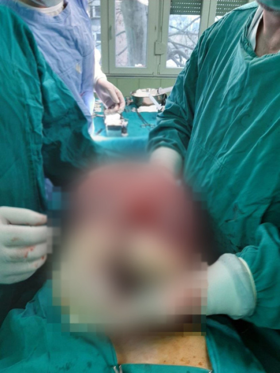 Srpski hirurg koji svakodnevno spasava živote: Priča o dr Vasku Tošiću (FOTO)