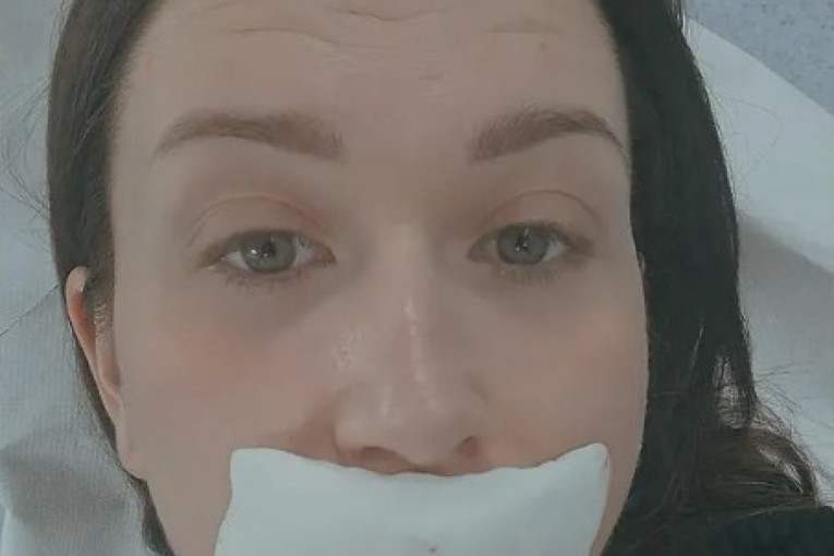 "Devojke, ne pravite grešku kao ja!" Pevačica izvadila silikone iz usana, objavila užasnu fotku! (FOTO)