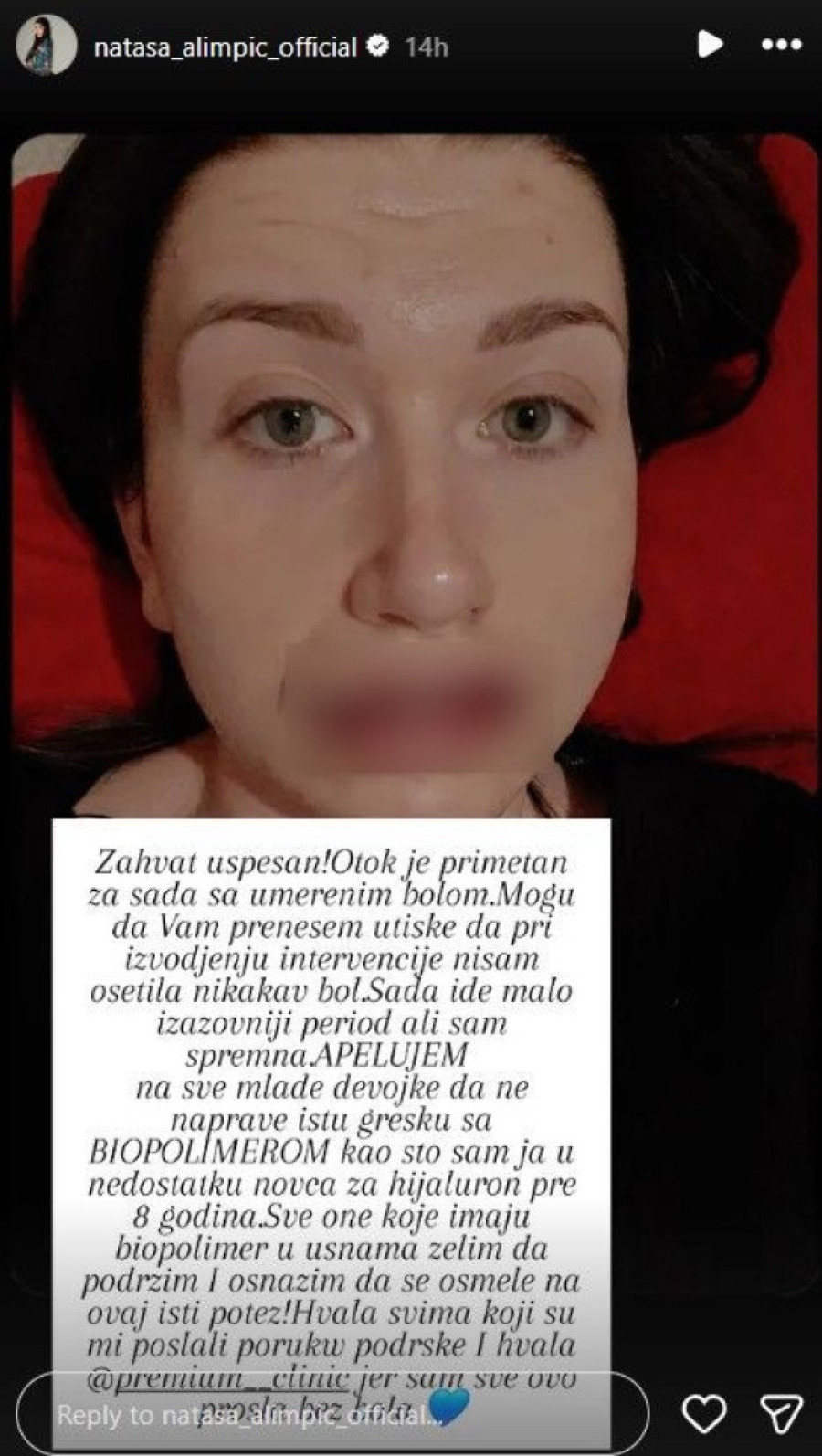 "Devojke, ne pravite grešku kao ja!" Pevačica izvadila silikone iz usana, objavila užasnu fotku! (FOTO)