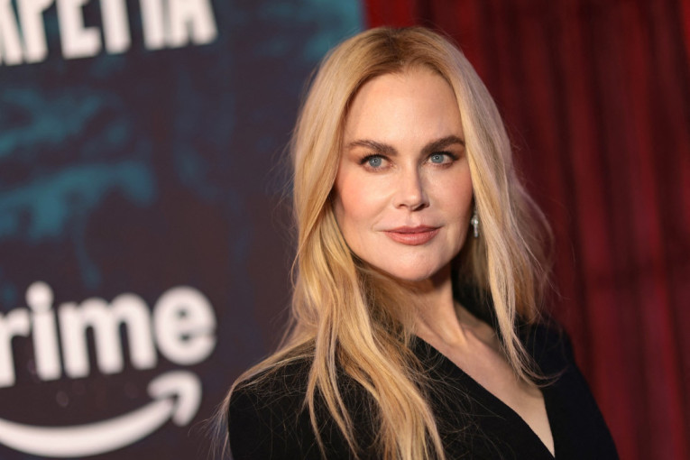 Nikol Kidman je zbog nove serije naučila nešto neverovatno: Umem da izvadim sve organe (FOTO/VIDEO)