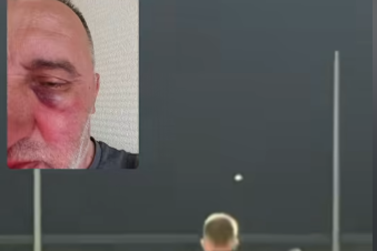 Skandal u BIH! Sloga otpužila Željezničar: Pretukli ste nam fotografa (VIDEO)