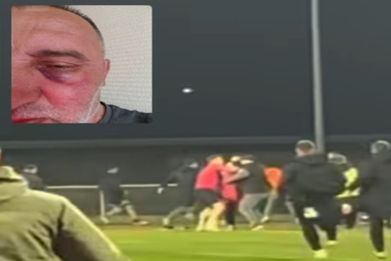 Skandal u BIH! Sloga otpužila Željezničar: Pretukli ste nam fotografa (VIDEO)