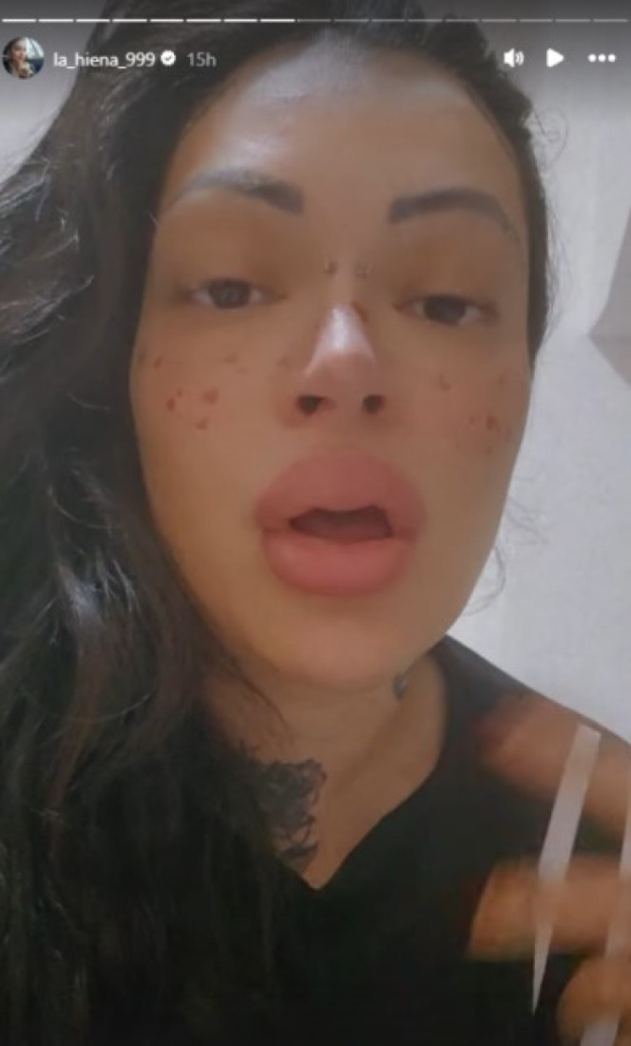 Dunja Ilić prolazi kroz pakao: Moram da se izlečim, od muke sam pojela nokat