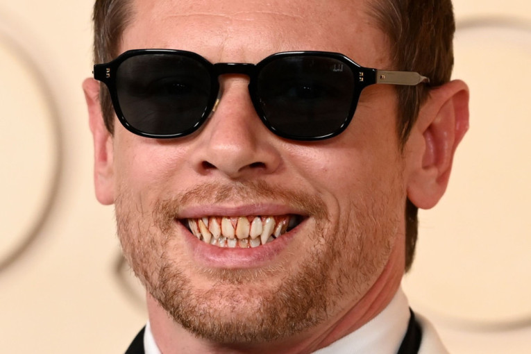 Kriza srednjih godina ili je ćapio brkove Pedru Paskalu? Leonardo Dikaprio šokirao izgledom na Oskarima (FOTO)