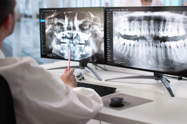 Čovek posetio stomatologa, a rendgenski snimak je otkrio neverovatnu stvar koja je oborila Ginisov rekord (VIDEO)
