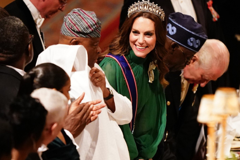 Čak i da hoću ne mogu da sakrijem: Deniz Ričards priznaje da je radila fejslifting, a evo šta je sve dotegla