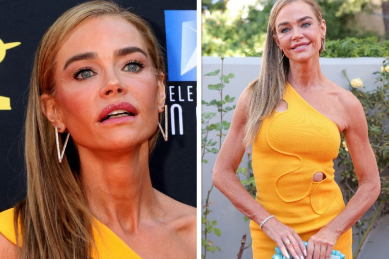 Čak i da hoću ne mogu da sakrijem: Deniz Ričards priznaje da je radila fejslifting, a evo šta je sve dotegla