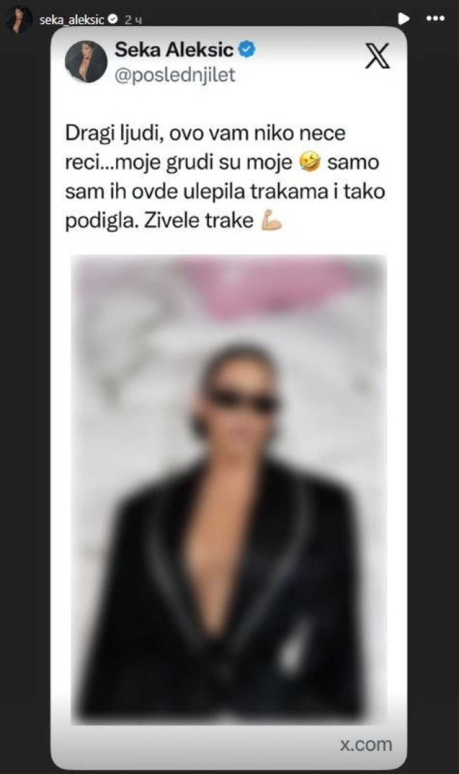 Dekolte u prvom planu! Seka Aleksić privukla svu pažnju, pa progovorila o estetskim zahvatima (FOTO)