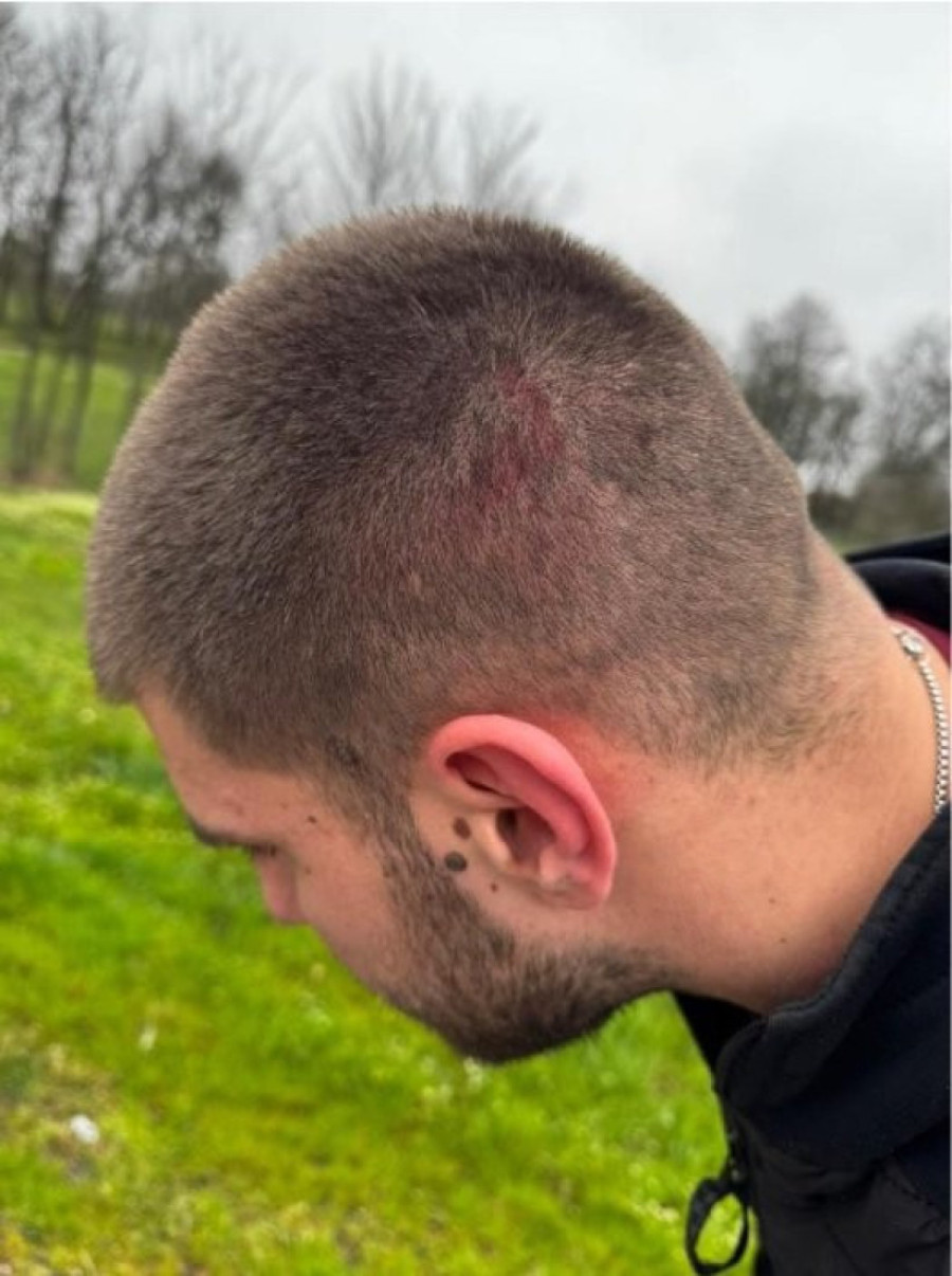 "On je došao da mene bije u mojoj Srbiji": Oglasio se Vukašin kog su blokaderi brutalno tukli!