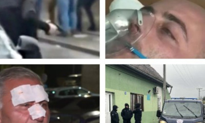 Najstrašnije scene blokaderskog nasilja tokom izbornog dana: Potezali pištolje, tukli aktiviste SNS, pokušali upad u štab (FOTO/VIDEO)