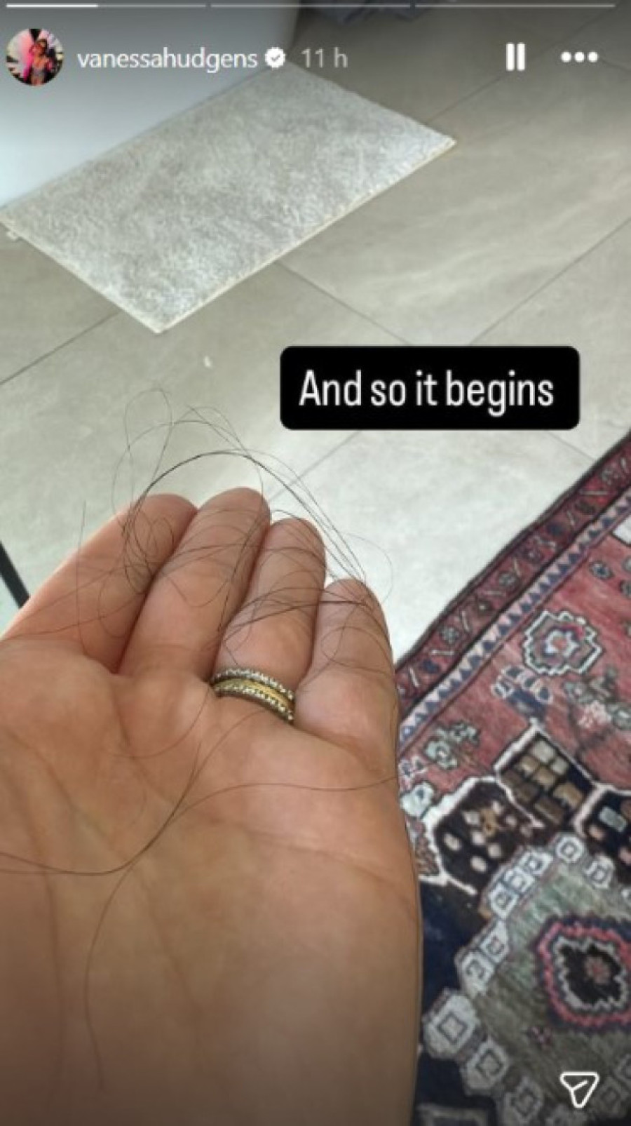 Pevačica otkrila sa čime se suočava nakon drugog porođaja: "Počelo je..." (FOTO)