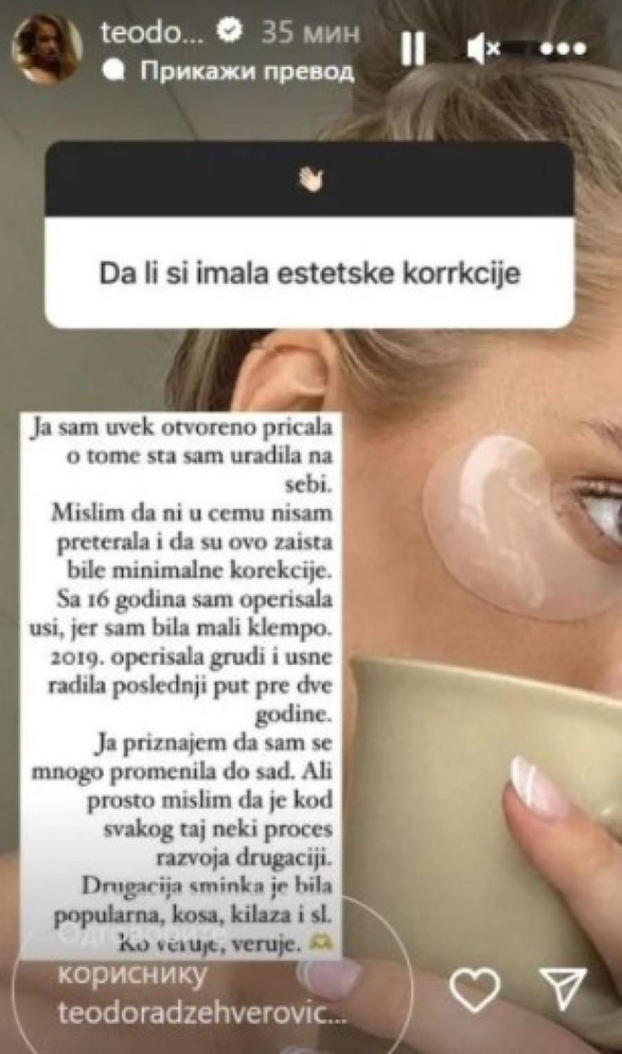 Teodora Džehverović sa 16 godina prvi put otišla pod nož: Priznajem da sam se mnogo promenila!