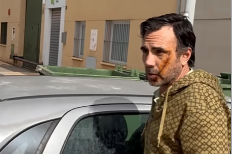 Žrtva napada u Malagi: Niste kontrolisali granice, pa lako ulazi ovaj šljam (VIDEO)