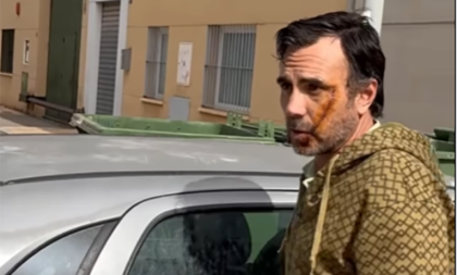 Žrtva napada u Malagi: Niste kontrolisali granice, pa lako ulazi ovaj šljam (VIDEO)