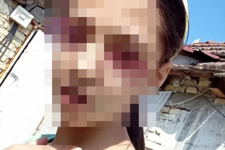 "Šta ako su skočili sa mosta" Otac nestale Dunje (15) u strahu, drama se produbljuje!