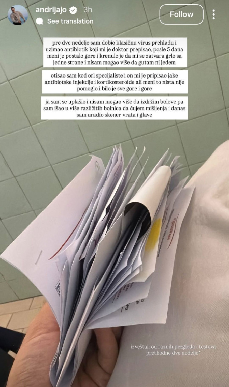 "Stvorila mi se ova lopta u glavi, antibiotici nisu bili od pomoći!" Srpski pevač hitno operisan (FOTO)
