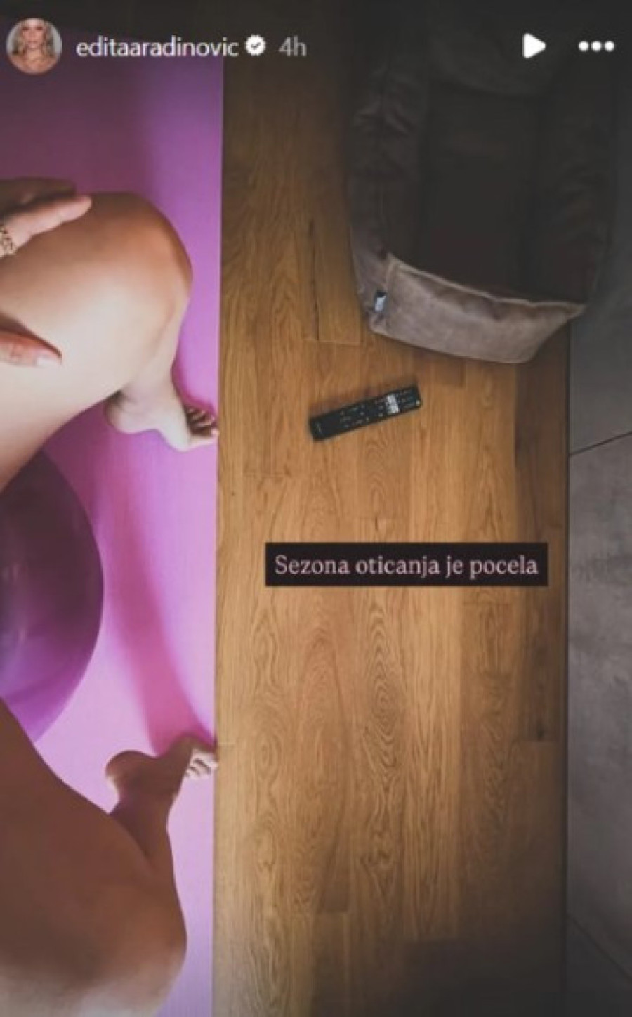 Edita otkrila s čim se suočava u trudnoći: Evo kroz šta prolazi (FOTO)