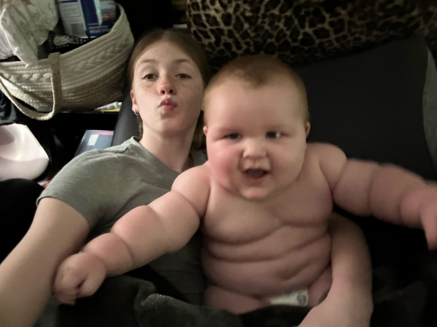 Ne staje u kolica ni hranilicu! Džinovska beba sa osam meseci ima skoro 16 kilograma i već nosi garderobu za petogodišnjake (FOTO)