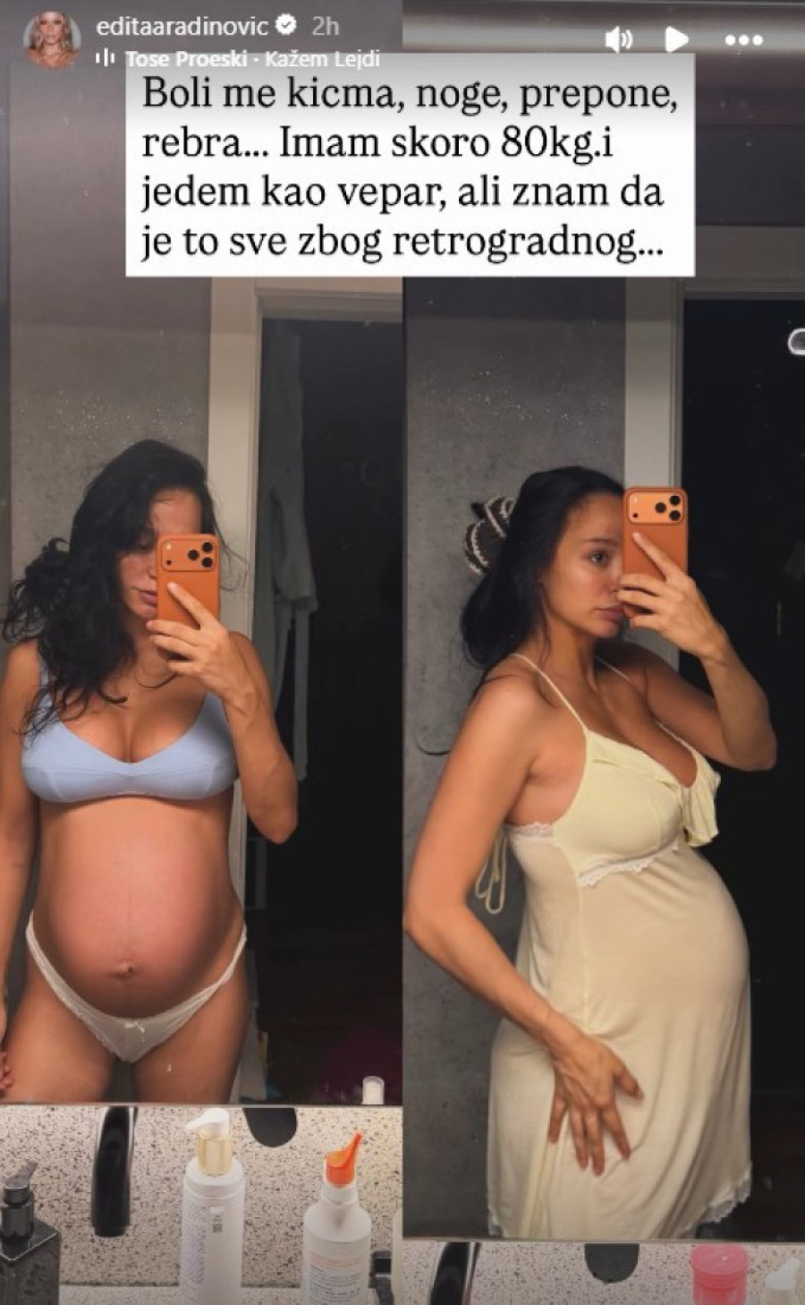 "Jedem kao vepar" Edita otkrila koliko ima kilograma tik pred porođaj: "Boli me kičma" (FOTO)