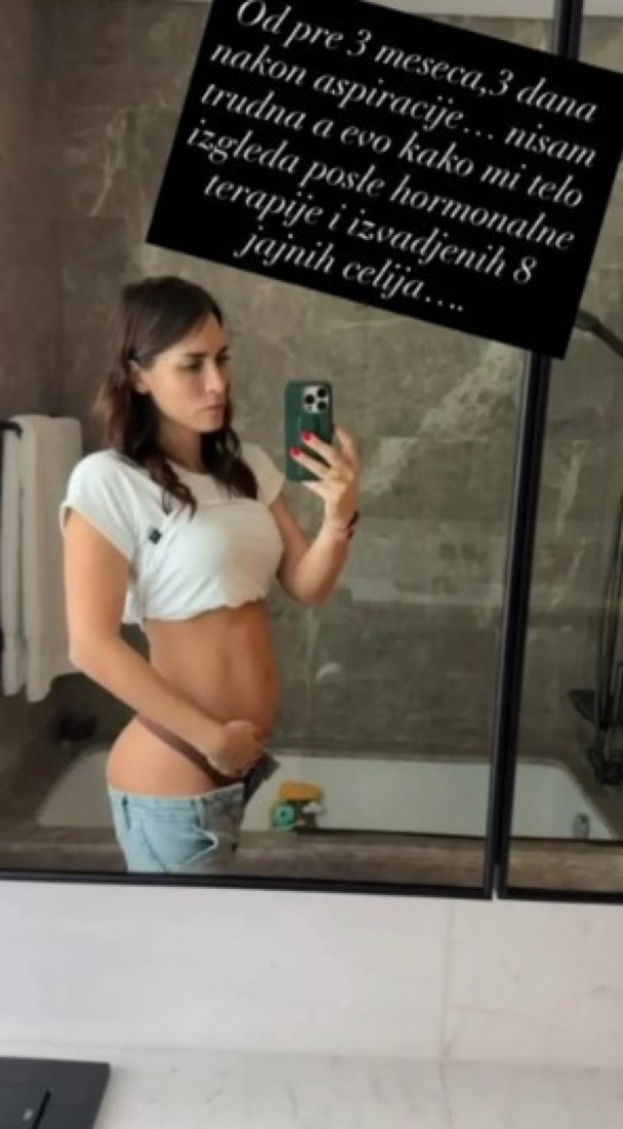 "Nisam trudna..." Manekenka pokazala kako joj telo izgleda nakon vađenja jajnih ćelija (FOTO)