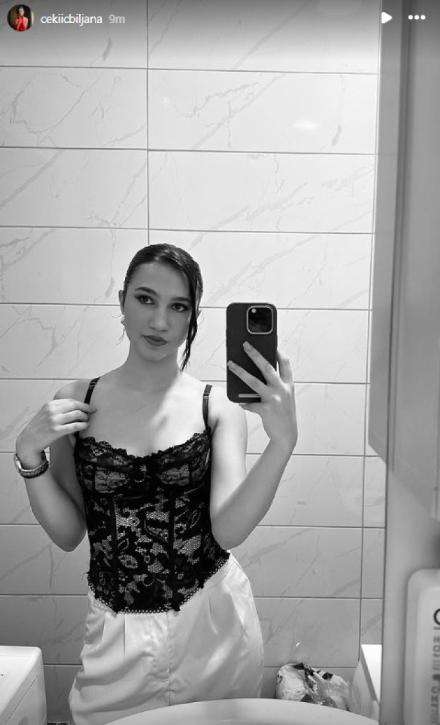 Dara iz Jasenovca izašla iz bolnice: Pokazala kako izgleda posle strašne saobraćajke! (FOTO)