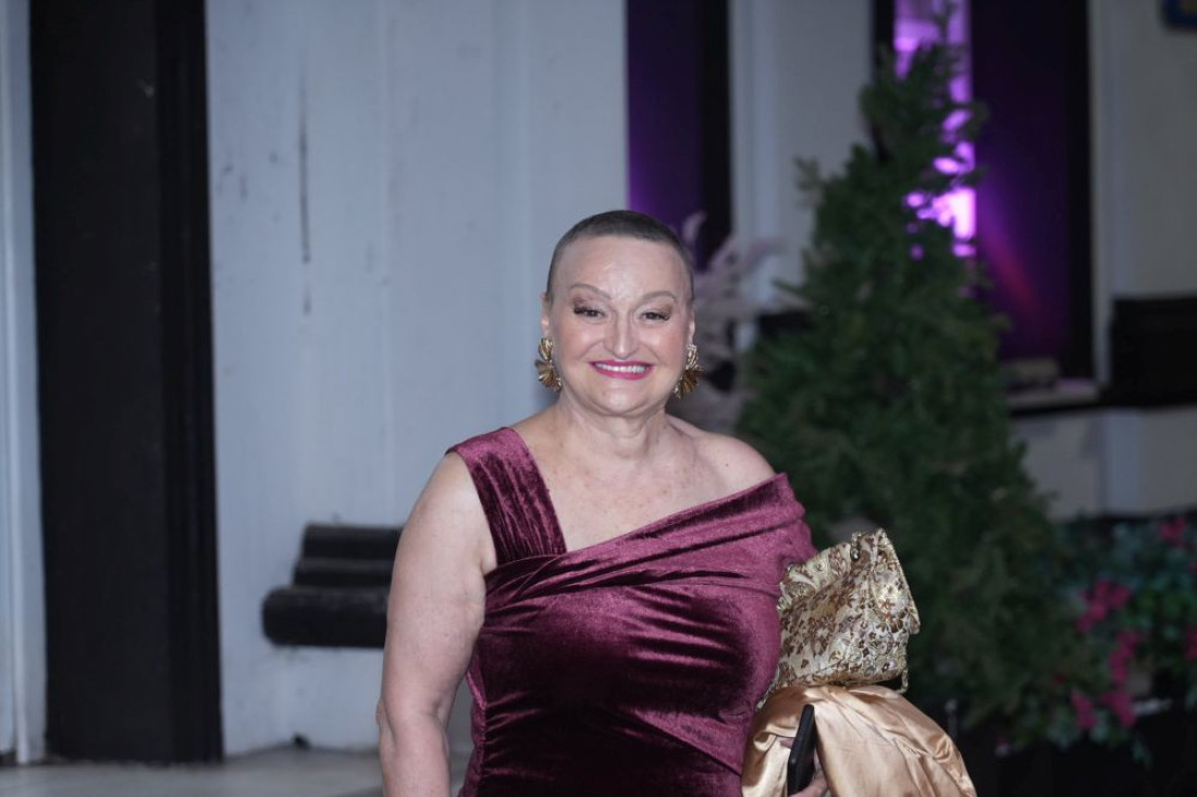 Milica Dugalić otvoreno o posledicama terapije: Kad sam skinula periku, znala sam da je to hrabrost!