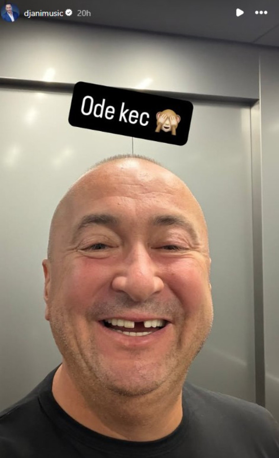 Đani spreman da iskešira 10.000€ za nov osmeh? Odluka pala čim je ostao bez keca! (FOTO)