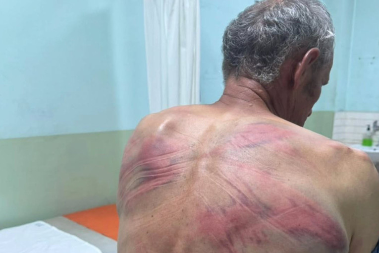 "Vezali ga za drvo i brutalno tukli“ Srpska lista o slučaju Srbina iz Zubinog Potoka: Traže hitnu istragu