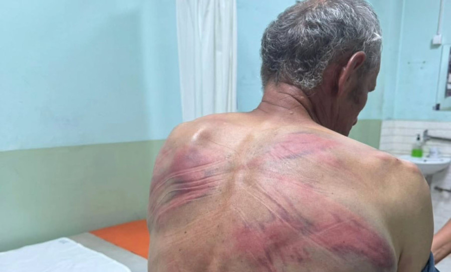 "Upadali su u kuću, zastrašivali mi sina" Ispovest Srbina koji je zverski pretučen u Zubinom Potoku (VIDEO)