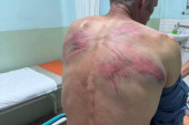 "Upadali su u kuću, zastrašivali mi sina" Ispovest Srbina koji je zverski pretučen u Zubinom Potoku (VIDEO)